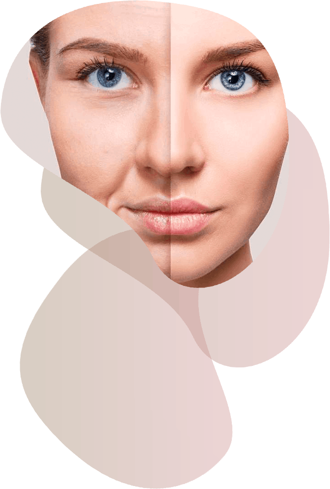 Rejuvenescimento facial