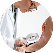 Carcinoma Basocelular